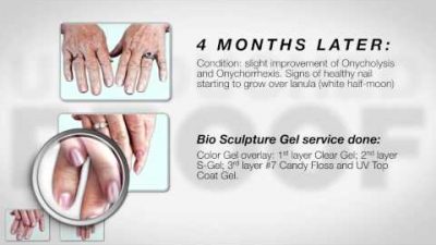 5 Star Safety With Bio Sculpture